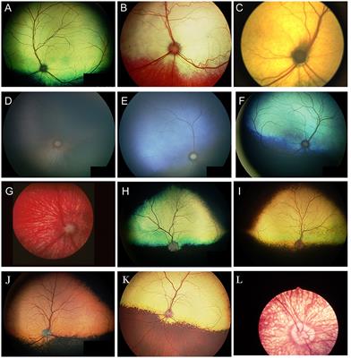 Manifestations of systemic disease in the retina and fundus of cats and dogs
